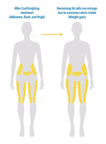 weight gain on file reference 1